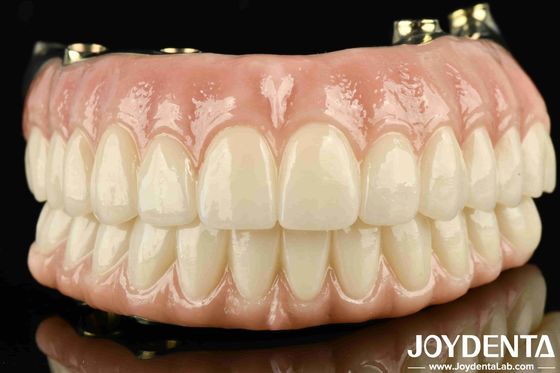 Ponte ibrida in zirconia a base di ti-bar ad alta resistenza