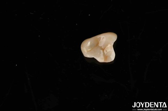 Materiale non tossico E-max Soluzione finale Emax Inlay Onlay per gli standard di biocompatibilità