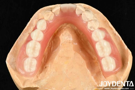 Diversi e leggeri materiali di resina finitura protesi acriliche