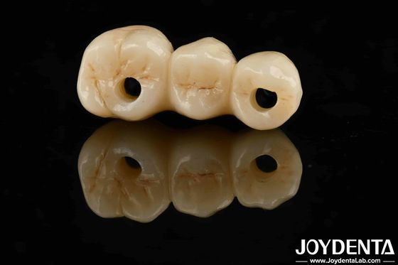 Alta estetica Alta resistenza flessibile 1000 MPa Full Zirconia For Standards