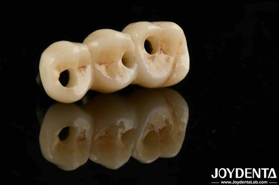 Biocompatibilità eccellente e alta resistenza colore realistico full zirconia per soluzioni di approvvigionamento B2B