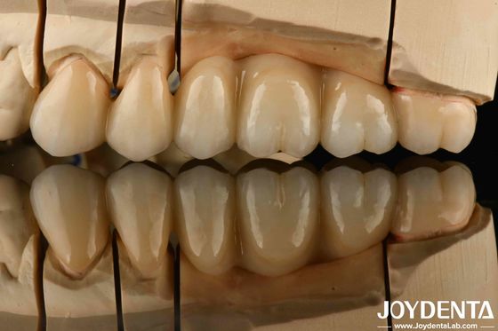 Bianco pieno di zirconia con alta resistenza allo shock termico