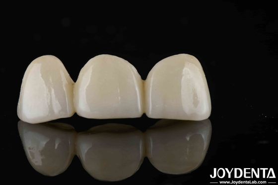 Stile naturale con strati pieni di zirconia Alta traslucidità ed estetica