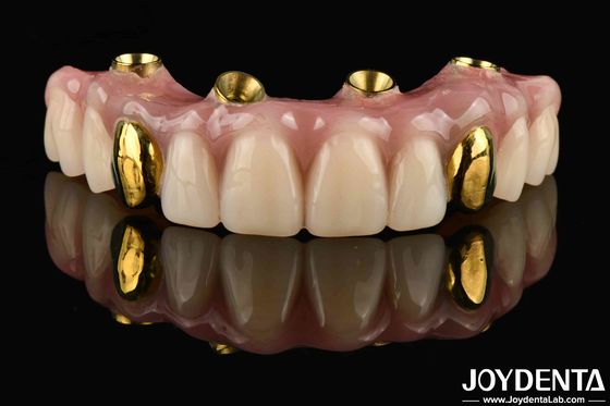 Finitura dentale acrilica a Ti-Bar trasparente e dal buon odore per la soluzione dentale