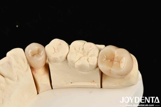 Biocompatibilità eccellente Zirconia completa con elevata resistenza alla corrosione e resistenza flessibile di 1000 MPa