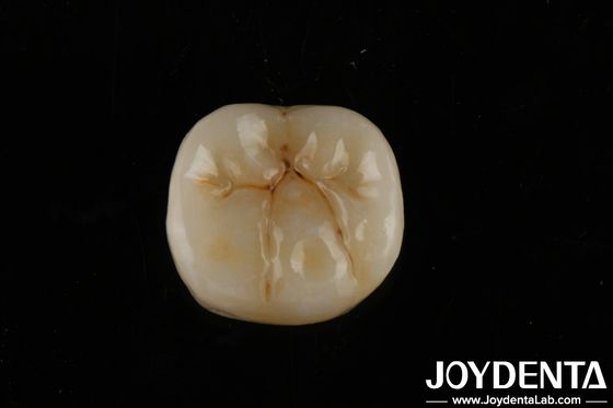Alta traslucidità Zirconia piena con strati Biocompatibilità e resistenza flessibile di 800 MPa