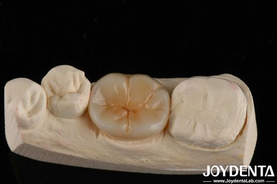800 MPa resistenza flessibile e 8 MPa·m1/2 resistenza alla frattura in zirconia a strati multipli per applicazioni di resistenza
