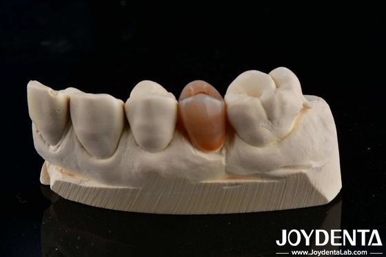 Biocompatibile e dall'aspetto naturale Multilayer Full Zirconia con estetica