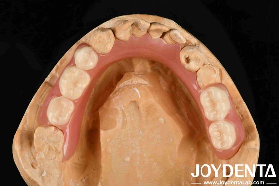 Personalizzazione Dentiera acrilica Finish Buona elasticità e proprietà leggera per migliorare le prestazioni protesiche
