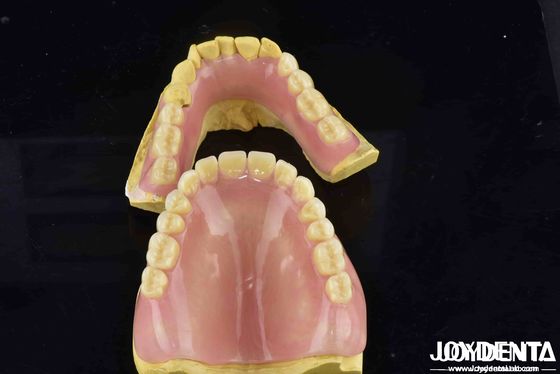 Scatenate il potenziale della vostra pratica dentale Dentiera acrilica Finish con proprietà diverse e leggere