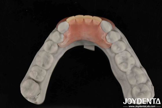 Portate il vostro studio dentale al livello successivo Denti flessibili con finitura morfologica naturale e personalizzazione.