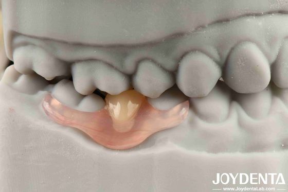 Flessibile finitura protesi personalizzata e tecnologia avanzata di disposizione dei denti per esigenze personalizzate