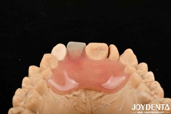 Alta stealth buona elasticità finitura flessibile protesi per diversi processi di produzione