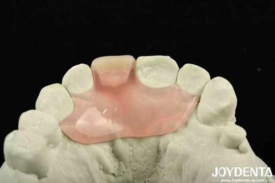Personalizzazione Flessibile Denture Finish utilizzando la tecnologia di disposizione dei denti con buona elasticità