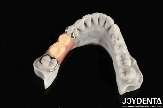 Struttura orale stabile per gli odontoiatri nel collegare saldamente i denti in fila