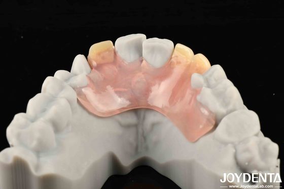 Struttura orale stabile Quadro di effetto Impostare denti Finitura Belle e armoniosa aspetto