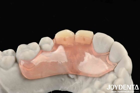 Bello e armonioso aspetto progettazione quadro impostare denti finitura tecnologia elaborata per la struttura orale stabile