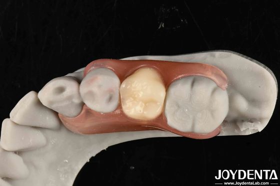 Rivoluzionare il tuo quadro di pratica dentale Impostare denti con tecnologia elaborata dal dentista