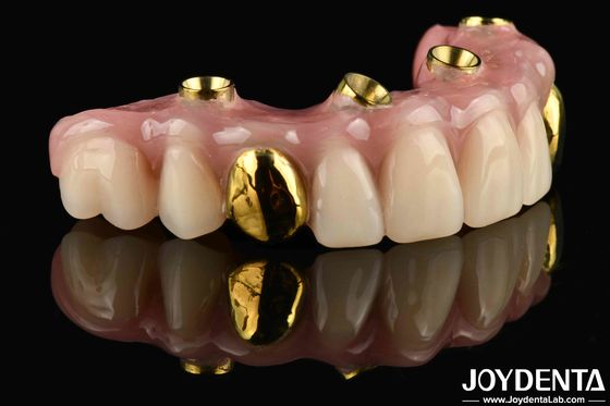 50 ml di dentare dagli Stati Uniti La tua soluzione definitiva Ti-Bar Acrylic Dental Finish per il trattamento dentale