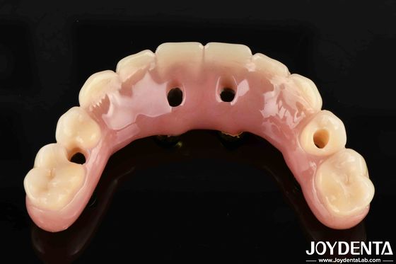 50ml Ti-Bar Acrylic Teeth Finish 24 ore Tempo di guarigione Stati Uniti per professionisti dentali