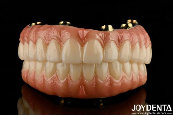 Denti e gengive naturali Puente ibrido di zirconia in Ti-Bar compatibile con elevata biocompatibilità