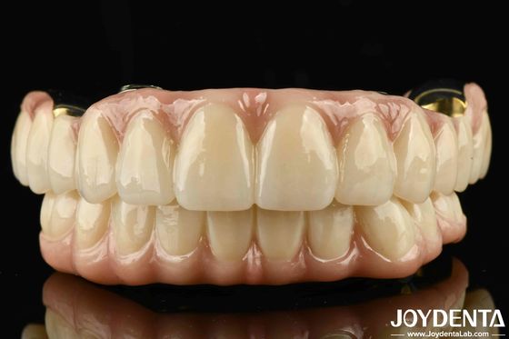 Ponte ibrida in zirconia a ti-bar di eccellente resistenza per la compatibilità di denti e gengive naturali