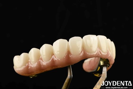 Ponte ibrida di zirconia in ti-bar resistente, realizzata con materiali di titanio e zirconia per il lavoro pesante