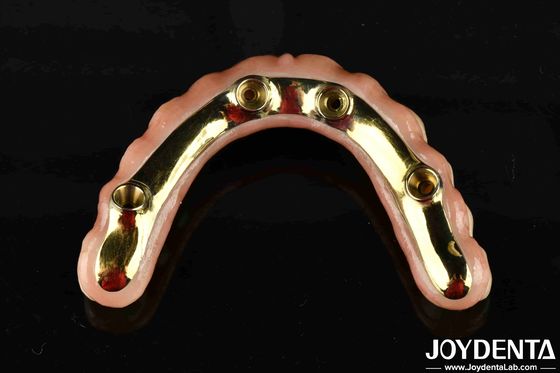 Comodo da indossare Ti-Bar ripristina la funzione di masticazione Essential Ti-Bar Zirconia Hybrid Bridge Per transazioni B2B