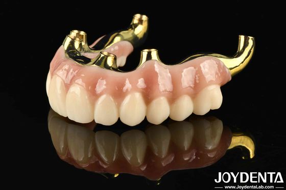 Ripristino della funzione masticatrice Ponte ibrida in zirconia a ti-bar con elevata biocompatibilità e adattamento preciso