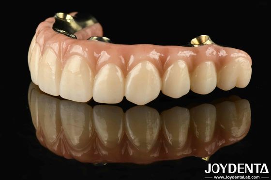 Ponte ibrida di zirconia in Ti-Bar su misura resistente alla corrosione e all'usura ripristinando la funzione di masticazione con precisione