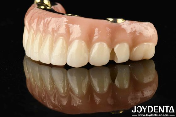 Trasforma il tuo restauro dentale con un ponte ibrido in zirconia in Ti-Bar