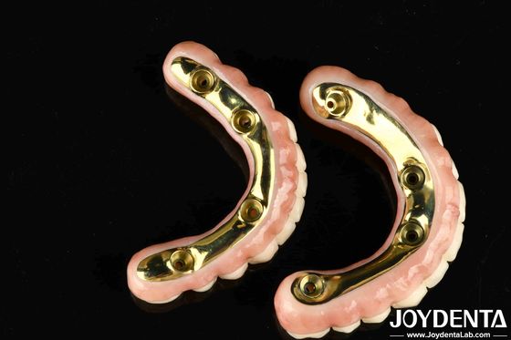 Estetica naturale Ponte ibrida in zirconia con elevata durata e biocompatibilità Ponte ibrida in zirconia in Ti-Bar