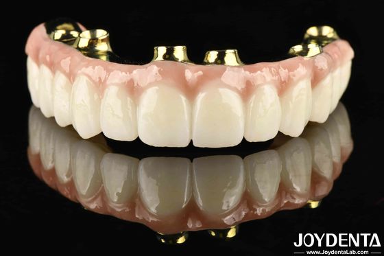 Ponte ibrido di zirconia in ti-bar altamente resistente e di lunga durata con resistenza alla corrosione e all'usura