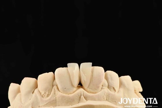 Alta resistenza Micro Veneer spessore 0,2 mm e prestazioni affidabili