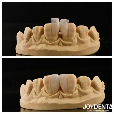 Facile da installare Micro Veneer Soluzione definitiva per la decorazione degli interni Spessore 0,2 mm