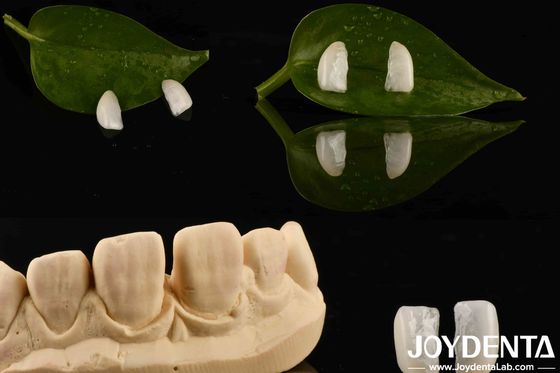 Alta Durabilità Micro Veneer Ultra Sottile Con Legno Naturale Spessore 0,2 mm