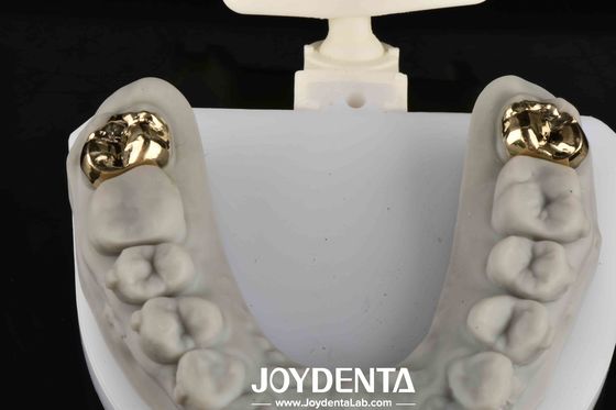 Ripristino orale con il dentista: un sorriso più luminoso e sano