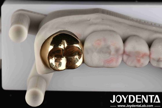 Corona d' oro di qualità professionale per uso dentale, orale e clinico Sì, resistenza all' abrasione