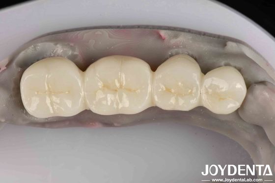 Prodotto bianco eccellente, pieno di zirconia, con elevata resistenza alla corrosione