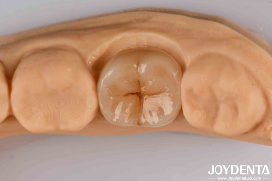 Applicazioni ad alta precisione di zirconia piena con elevata resistenza allo shock termico