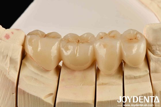 Libera l'estetica dell'alta estetica di zirconia piena di bianco e resistente agli urti termici
