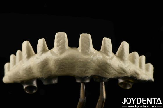 Tipo di connessione esessuale interna Abutments di impianto personalizzati sabbiati e incisi con acido per un'adeguatezza superiore