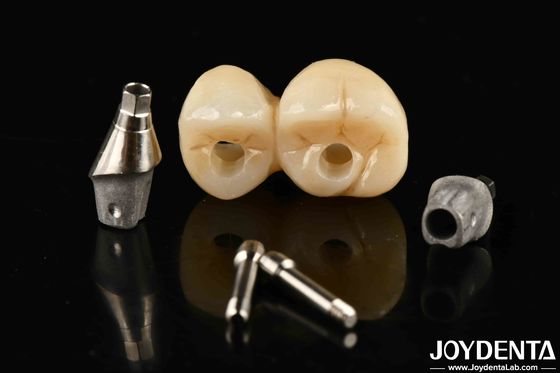 Sistema di ponte coronario con impianto di misura accurata e resistente alle macchie e alla decolorazione