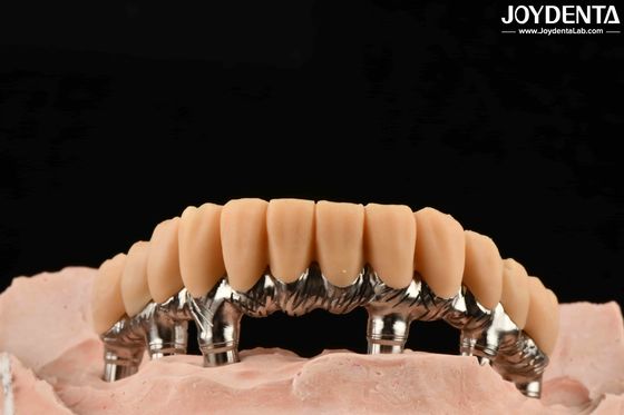 Resina gialla denti temporanei trattamento superficiale liscio preciso e stabile