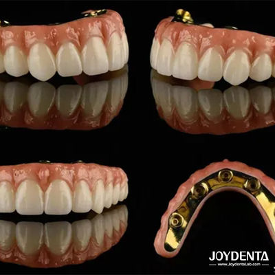 Ti Bar Zirconia Hybrid Implant Bridges High Translucency per protesi dentali