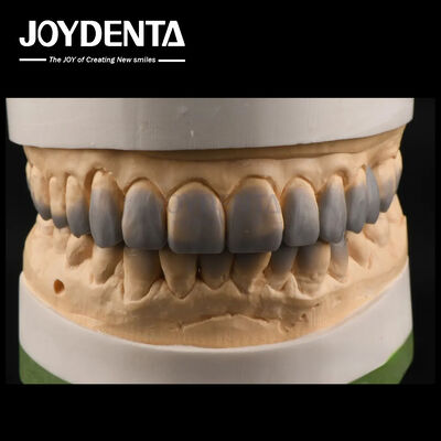 Uso temporaneo Ceramiche diagnostiche Tessitura liscia Denti Ceramiche personalizzate