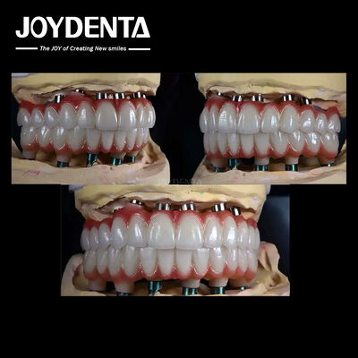 Impianto dentale multiplo in titanio da 10 mm Superficie ruvida per la restaurazione dentale