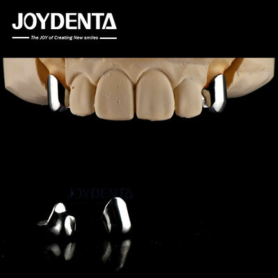 Protesi rimovibile di precisione Impianti dentali