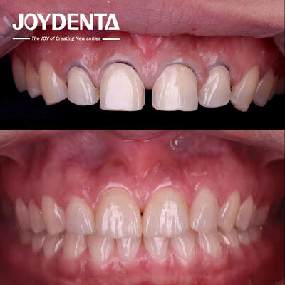 Cosmetica Odontoiatria Dental Veneers Lab.