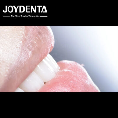 Durabilità della finitura composita dentale Buona biocompatibilità Non caduta finiture di porcellana